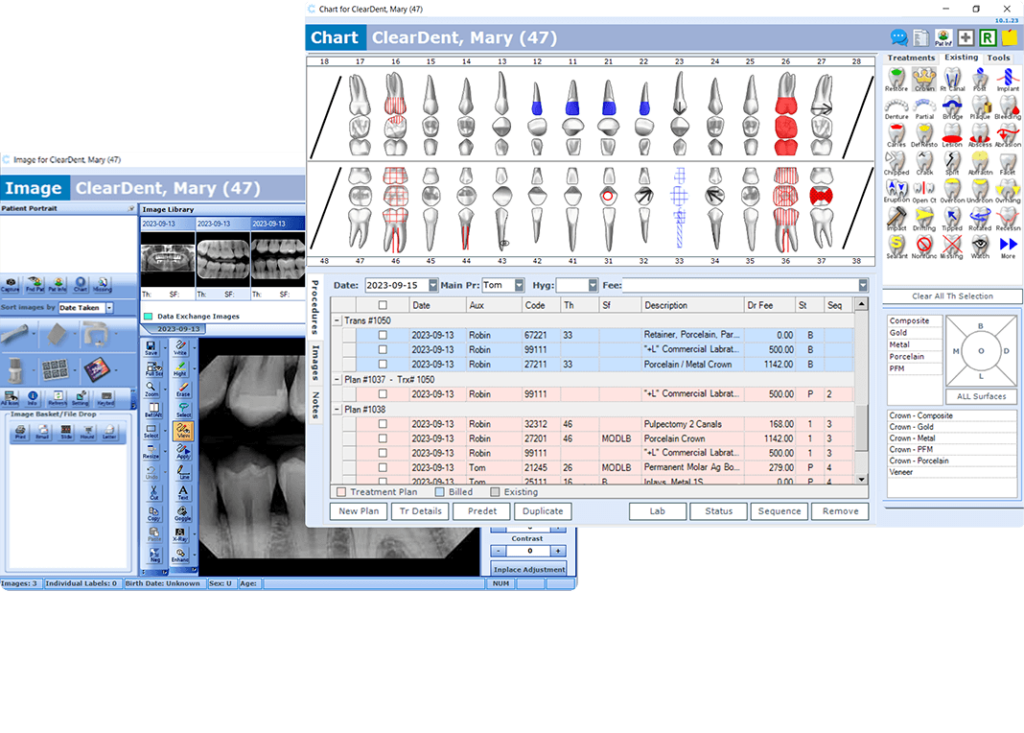 cleardent on premise clinical workflow